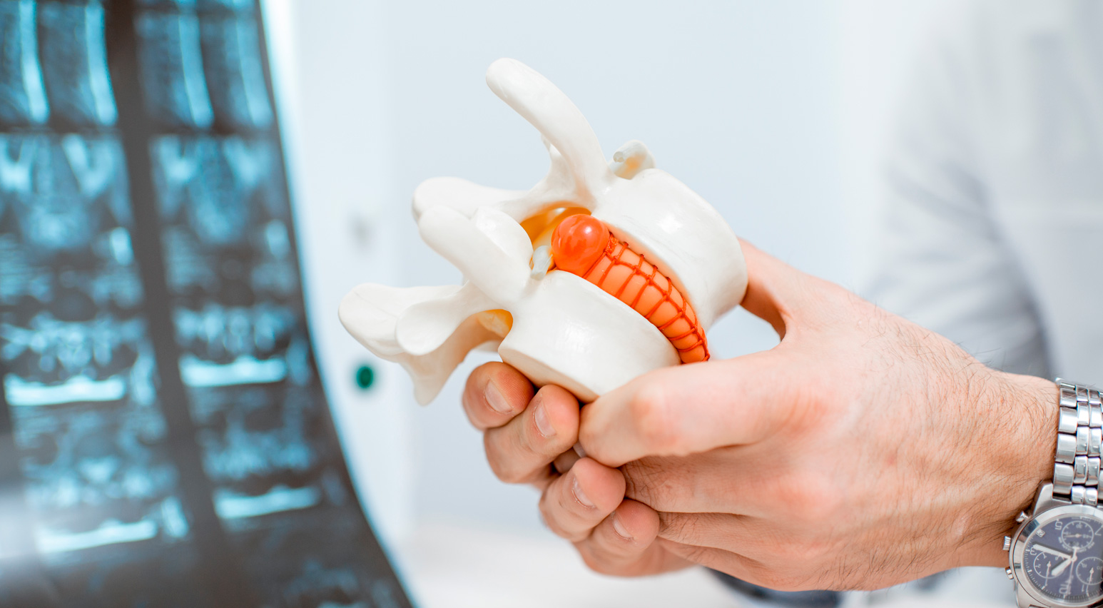 causas de una hernia de disco