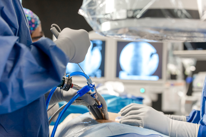 qué es una endoscopía de columna