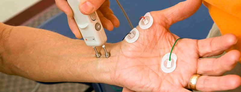 estudio de conducción nerviosa