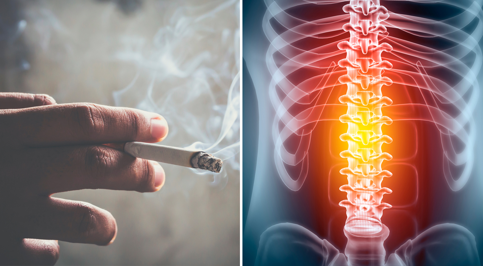 cómo fumar afecta la columna vertebral