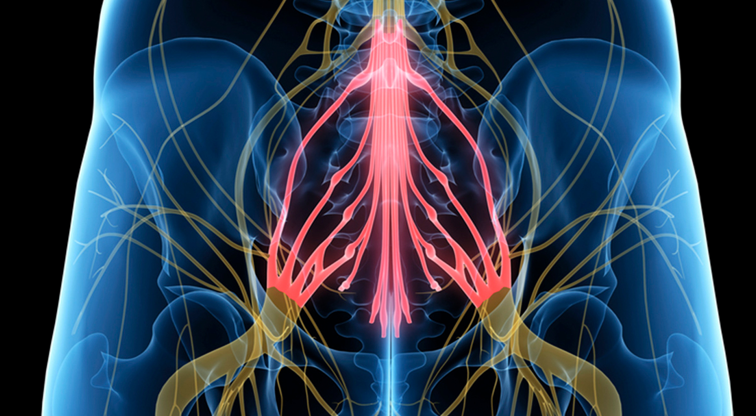 síndrome de cauda equina